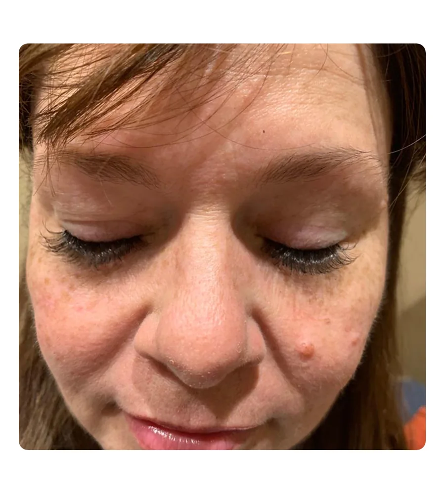 Skin care consultation and facial services
